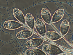 Stalked Ciliate Colony